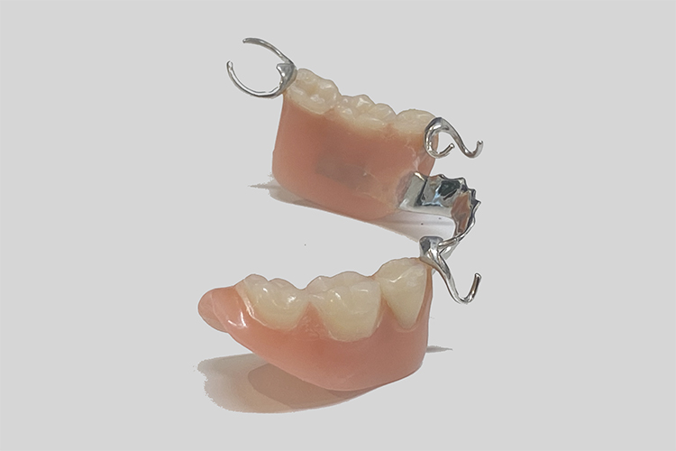 部分入れ歯 プラスチック義歯 保険適用