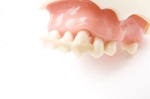 歯の根の露出した部分